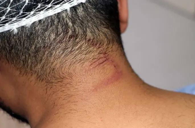 Gaziantep'te Doktoru demir sopa ve kemerle dövdüler..